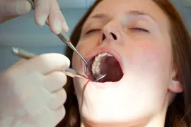 Women  with eyes closed  and jaw opened wide , having her teeth examined